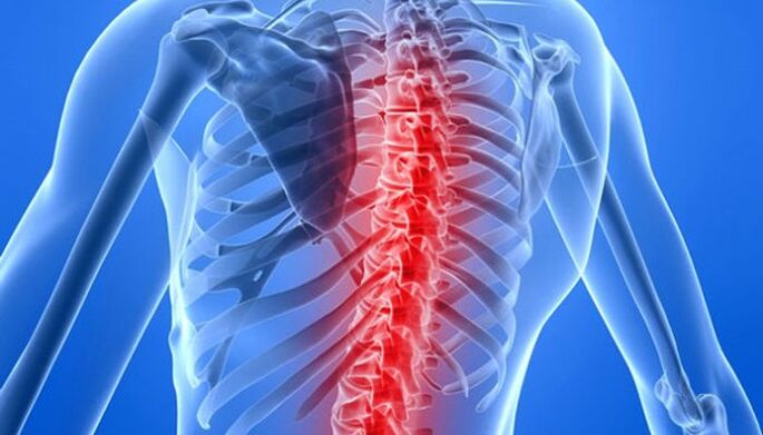 Les pathologies de la colonne vertébrale sont la cause la plus fréquente de maux de dos au niveau de l'omoplate