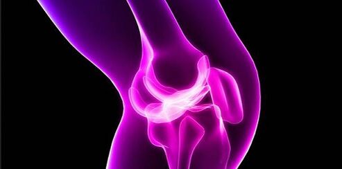 Arthrose dans l'articulation du genou