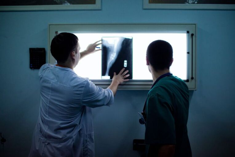 Diagnostic d'arthrose sur les rayons X