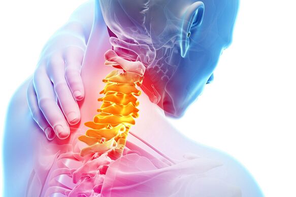 Ostéochondrose cervicale