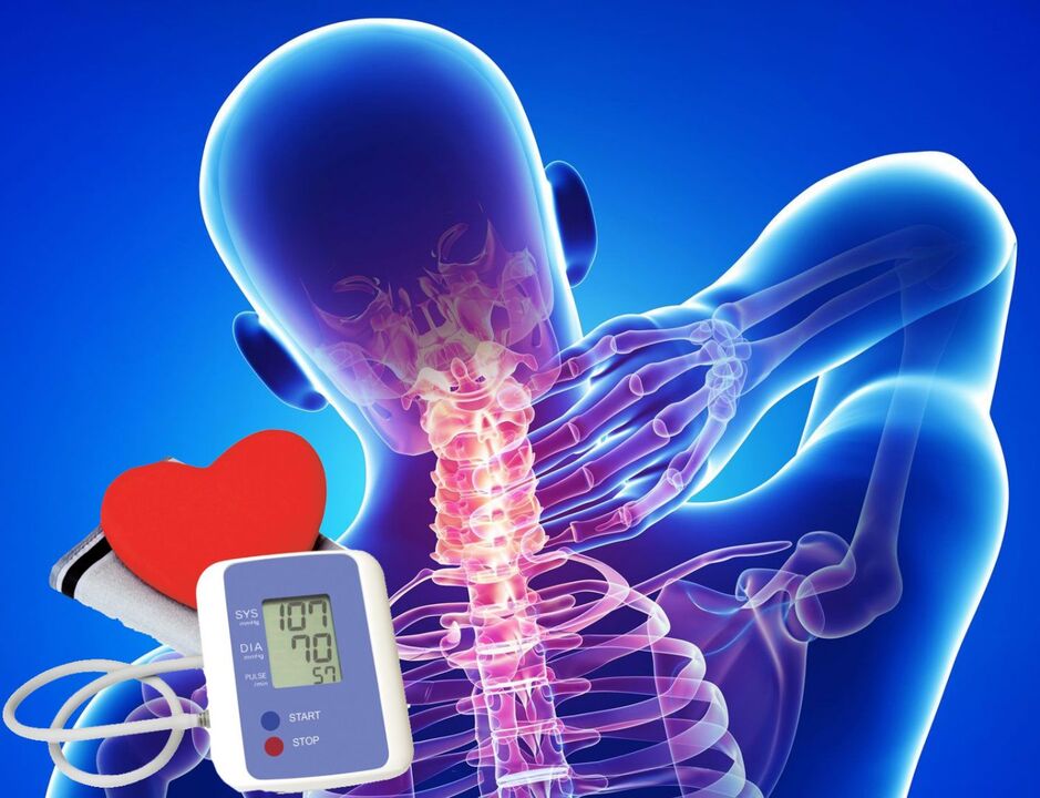 Sauts de tension artérielle dans l'ostéochondrose cervicale