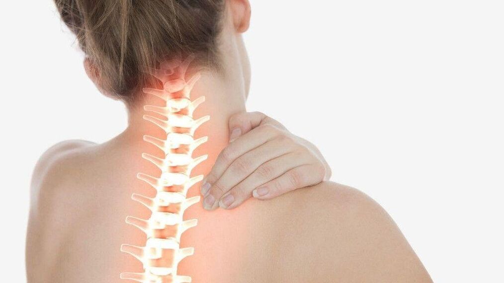 Un syndrome radiculaire peut se développer avec une ostéochondrose de la colonne cervicale